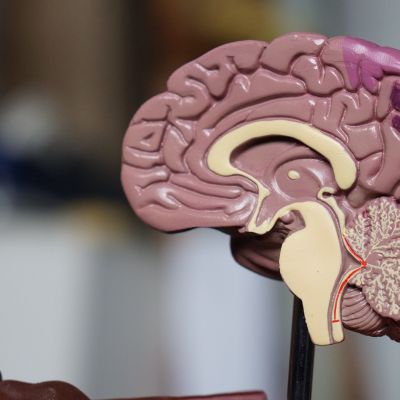 Memory Assessment Service :: Derbyshire Healthcare NHS Foundation Trust